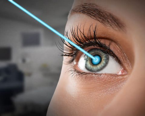 Lasik and Laser Eye Surgery