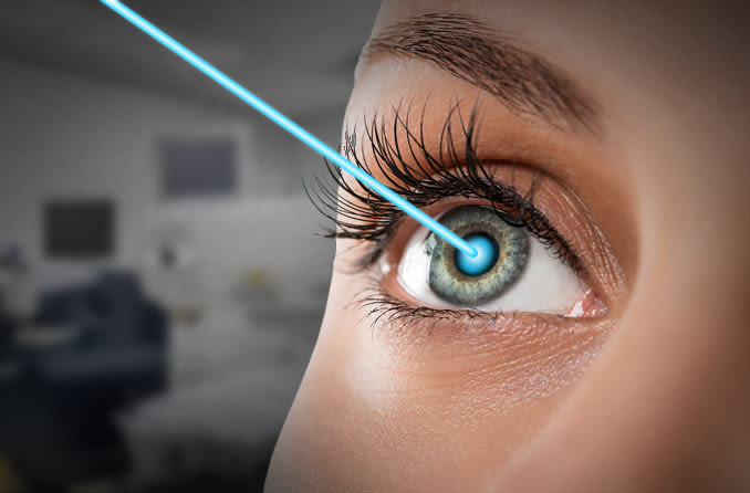 Lasik and Laser Eye Surgery